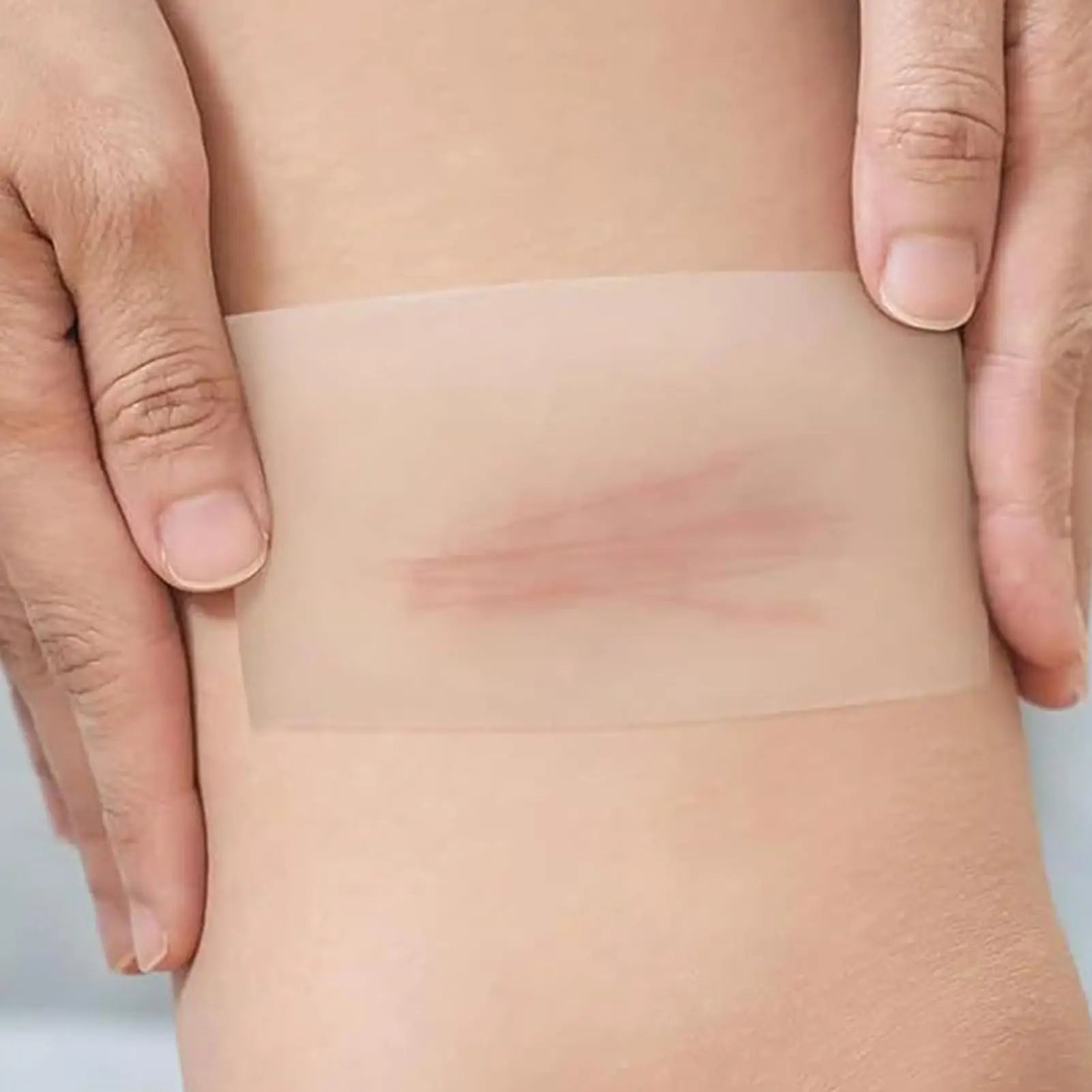 Waterproof Hydrocolloid Healing Tape